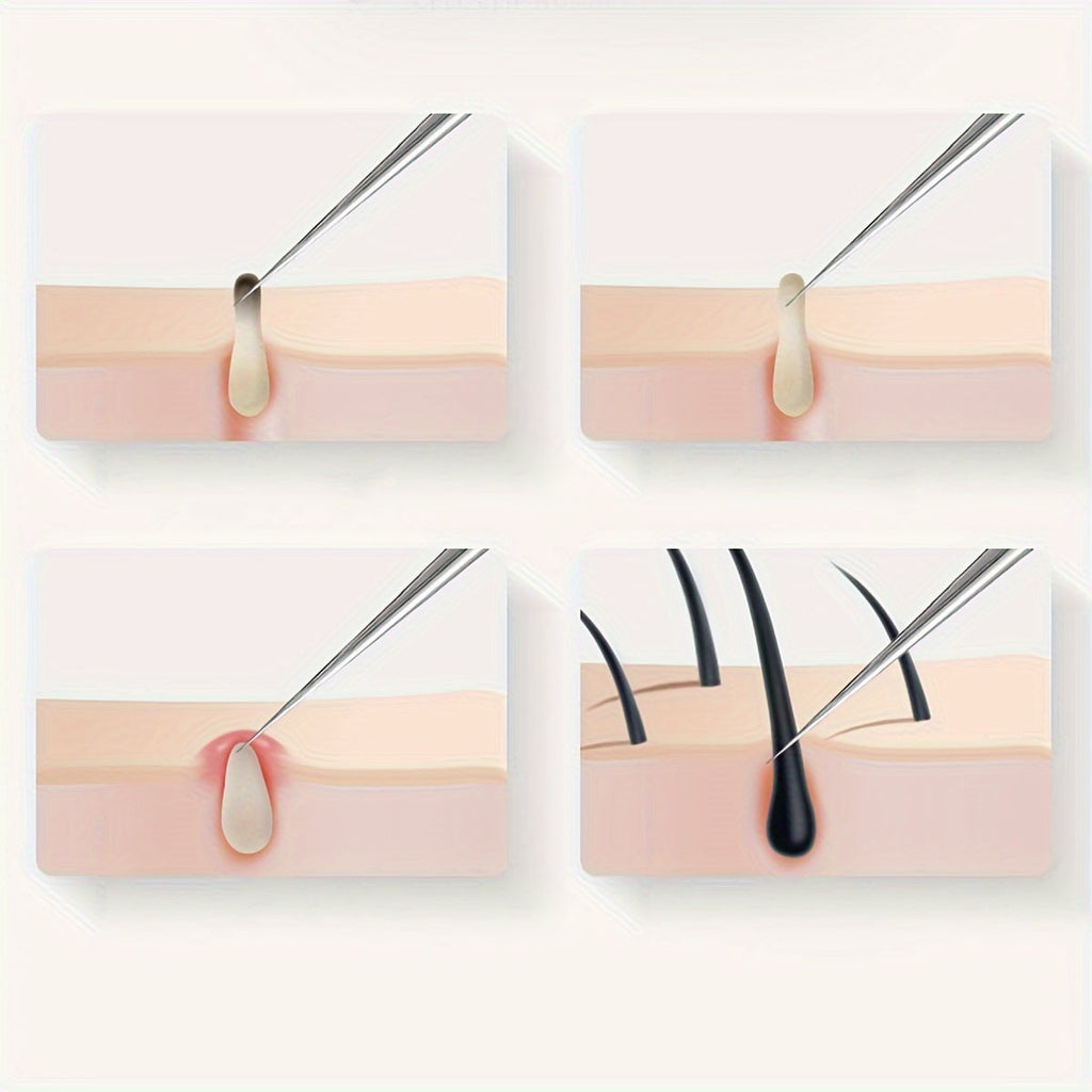 Odorless Stainless Steel Face & Nose Extractor for Whiteheads - Euroselle