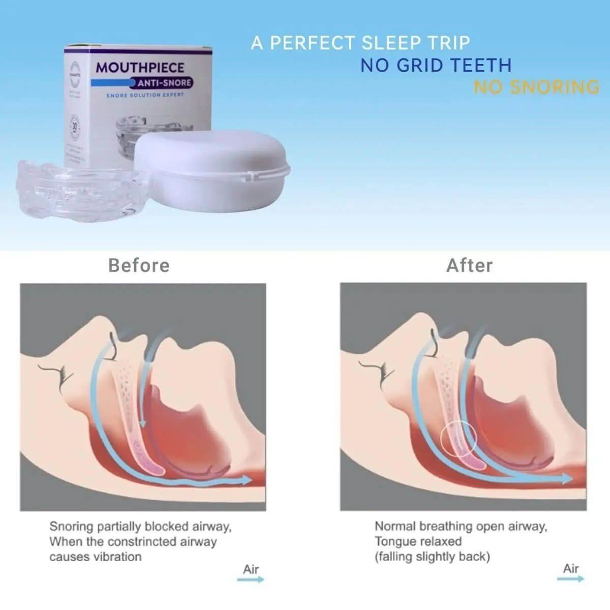 Dispositivo orale antirussamento NexSleep Guard — Design con avanzamento della mandibola inferiore, meccanismo per mantenere libere le vie aeree