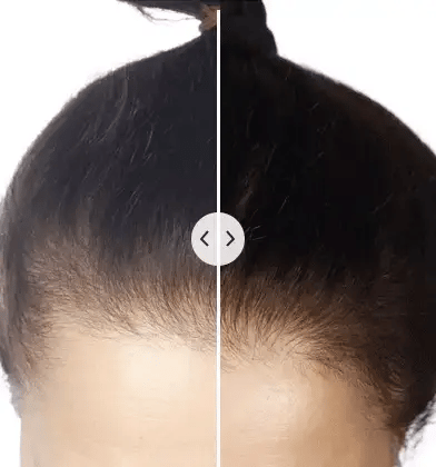 GlowFusion多功能美发梳 — 紧凑型5合1设计，头皮按摩，双光疗