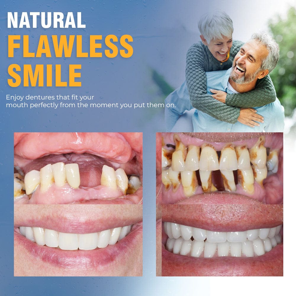 Facettes dentaires cosmétiques réutilisables pour adultes — Sourire à clipser doublé de silicone