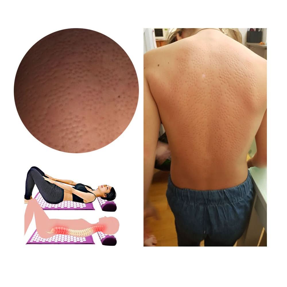 CalmFlex akupressur-yogamatta och kuddeset – tryckpunkter