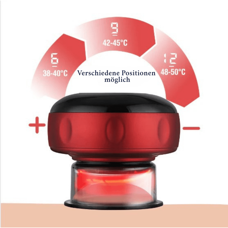 VitalFlow Electric Cupping Set — Adjustable Suction Control, Built-In 20-Minute Timer