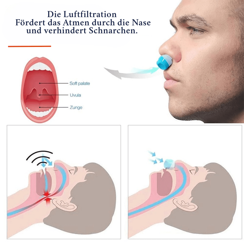 AeroSleep 防打鼾空气过滤系统——持续空气净化设备