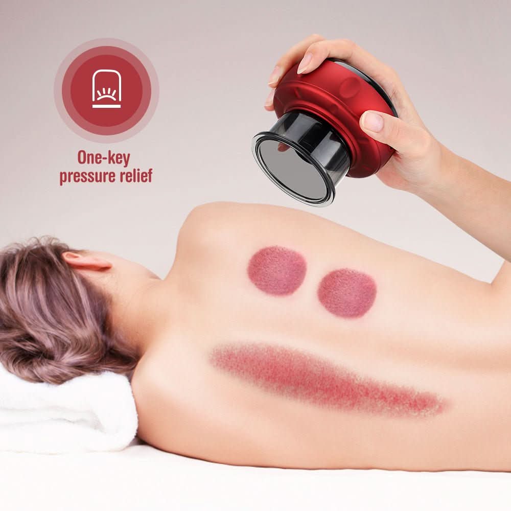 VitalFlow Electric Cupping Set — Adjustable Suction Control, Built-In 20-Minute Timer