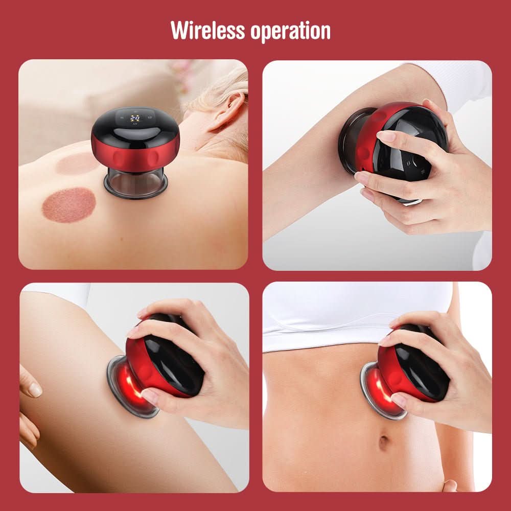 VitalFlow Electric Cupping Set — Adjustable Suction Control, Built-In 20-Minute Timer