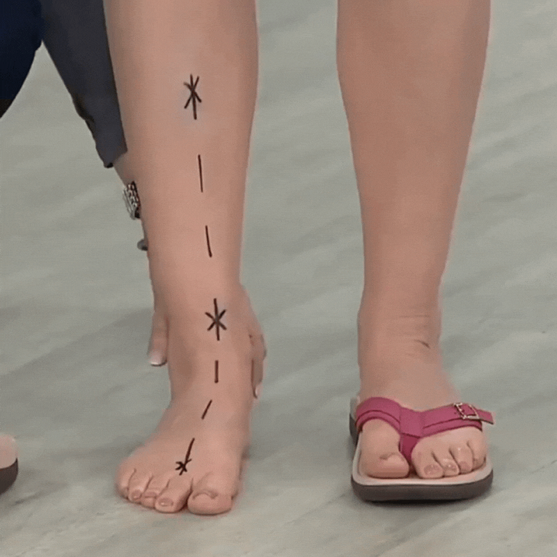 Sandales orthopédiques Alera — Soulagement des douleurs aux pieds et soutien de la posture
