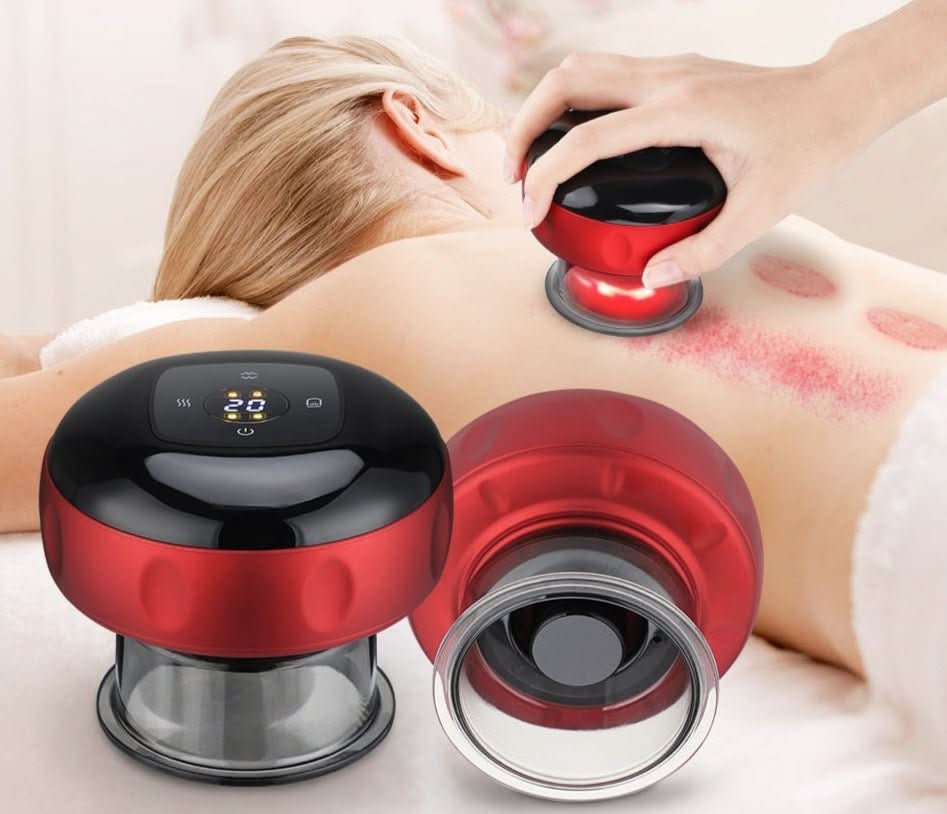 VitalFlow Electric Cupping Set — Adjustable Suction Control, Built-In 20-Minute Timer