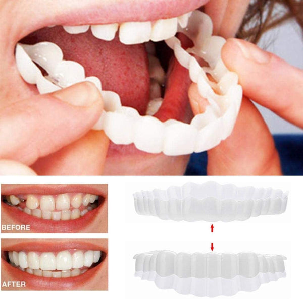Faccette dentali Instant Smile – arcata superiore e inferiore incluse | Euroselle