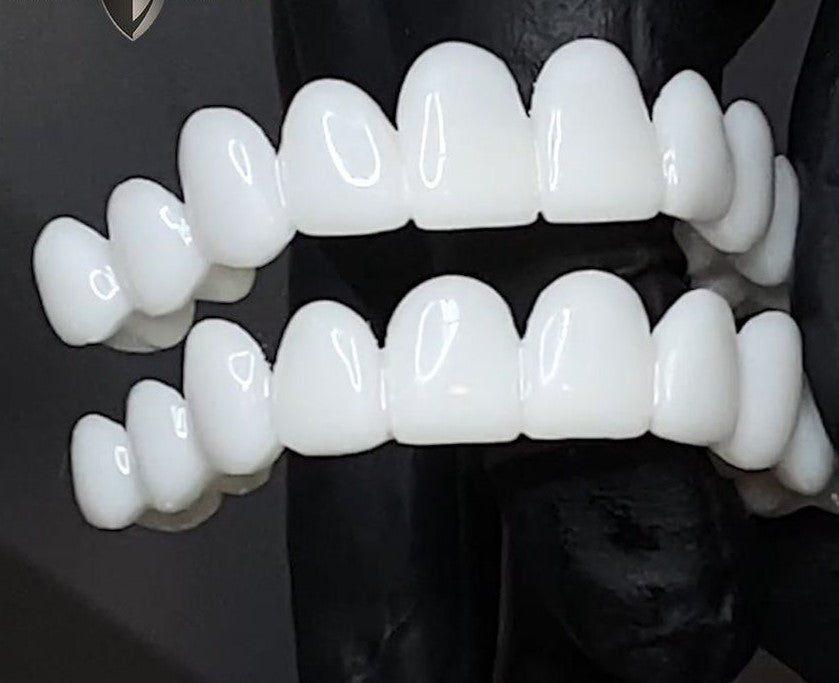 Felcsatolható kozmetikai héjak | Azonnali mosolyfedés a tökéletlenségek elfedésére | Euroselle