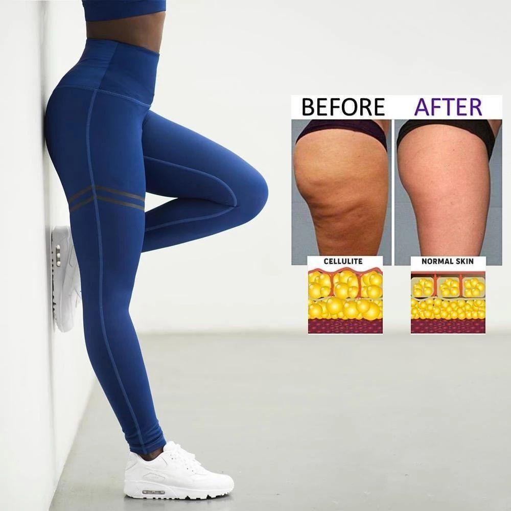 Női karcsúsító kompressziós leggings | Euroselle