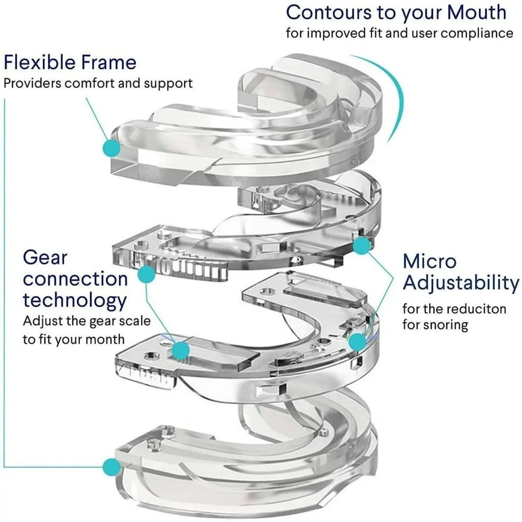 Dispositivo orale antirussamento NexSleep Guard — Design con avanzamento della mandibola inferiore, meccanismo per mantenere libere le vie aeree