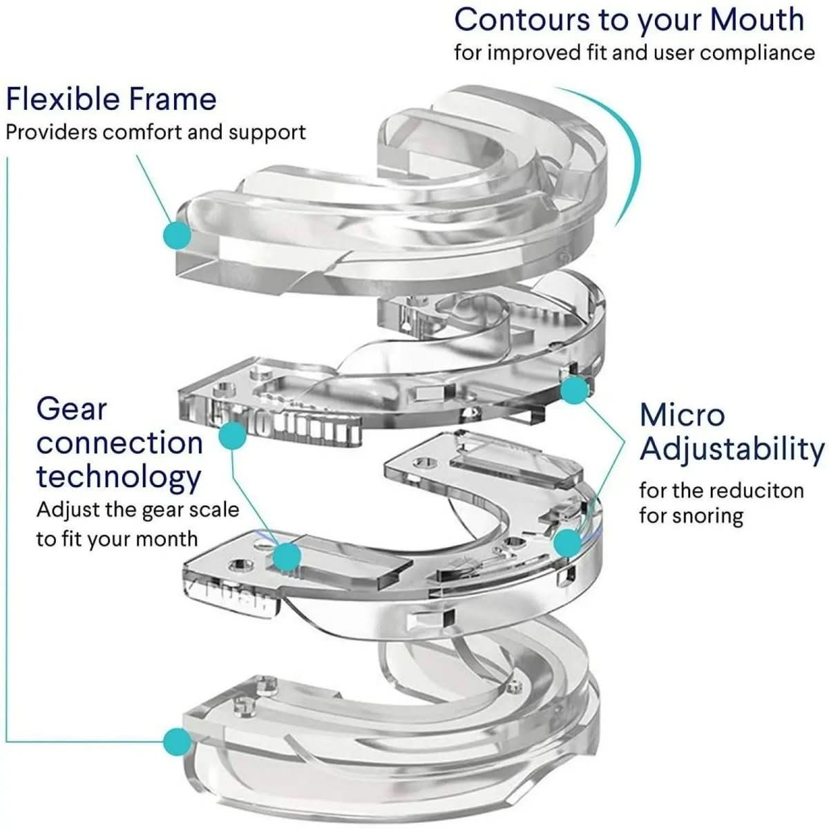 Dispositivo orale antirussamento NexSleep Guard — Design con avanzamento della mandibola inferiore, meccanismo per mantenere libere le vie aeree
