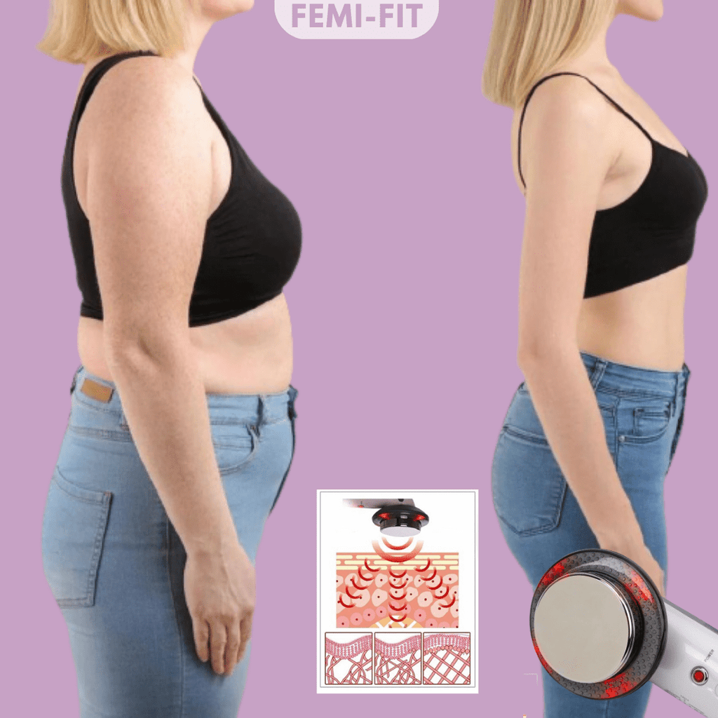 NovaSculpt 3-i-1-apparat mod cellulite og fedt — håndholdt EMS-, ultralyds- og infrarødt apparat