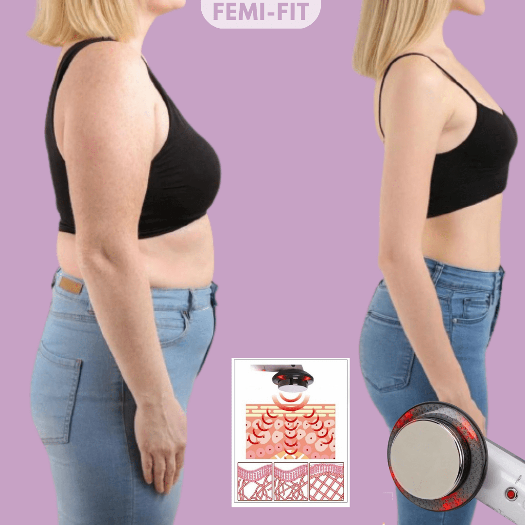 NovaSculpt 3-i-1-apparat mod cellulite og fedt — håndholdt EMS-, ultralyds- og infrarødt apparat