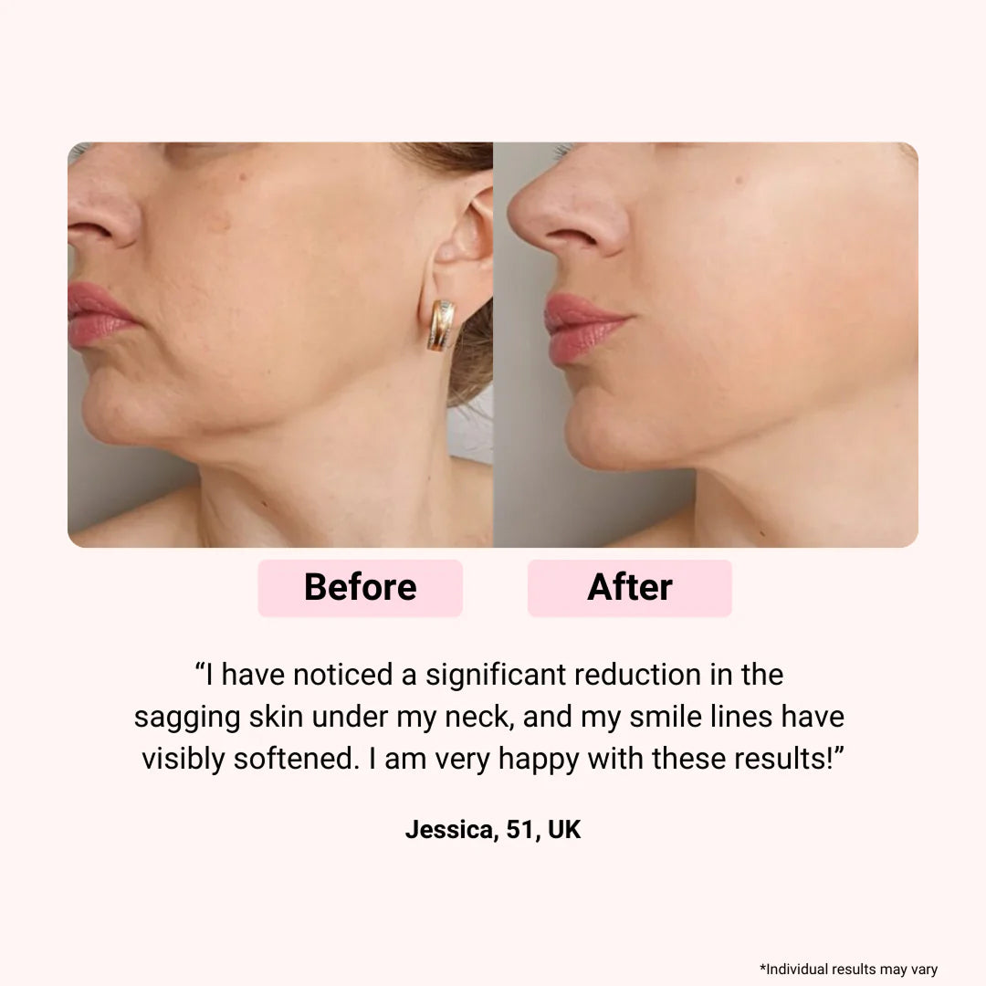 LED-Lichttherapiemaske fürs Gesicht — mehrfarbige Photonen, Anti-Aging, Fernbedienung