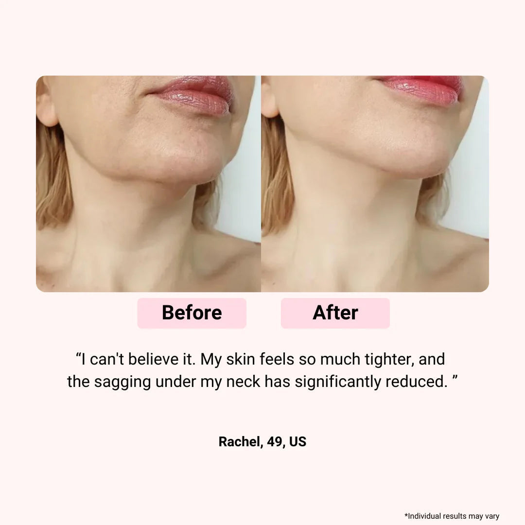 LED-Lichttherapiemaske fürs Gesicht — mehrfarbige Photonen, Anti-Aging, Fernbedienung
