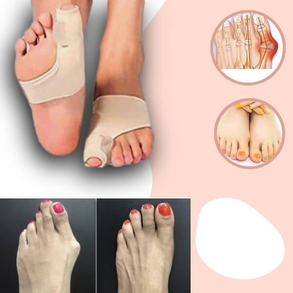 Big Toe Alignment Sleeve – Gel Cushion Pain Relief, Flexible Fabric